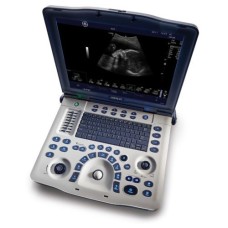 GE Logiq V2 Ultrasound System -Sale GE Logiq V2 Ultrasound System -Sale